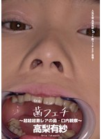 歯フェチ ～超超超激レアの歯・口内観察～ 高梨有紗