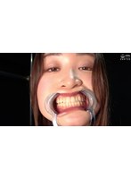 人気女優 中園めいなチャンの歯・口内・のどちんこ・舌ベロ観察プレイ！！！