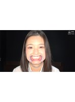 「【歯・口腔フェチ】制服美女 雪奈真冬チャンの超貴重な綺麗な口内＆のどちんこ観察！」雪奈真冬