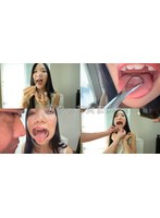 【個人撮影】桃瀬まゆの舌ブラシで「汚舌苔」採取